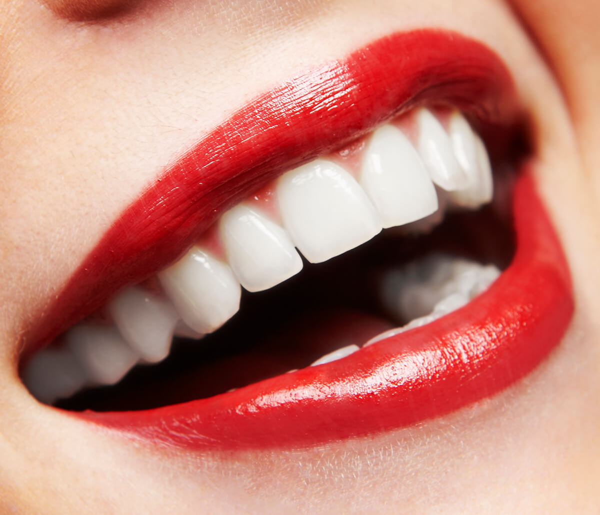 teeth-whitening-archives-starbrite-dental